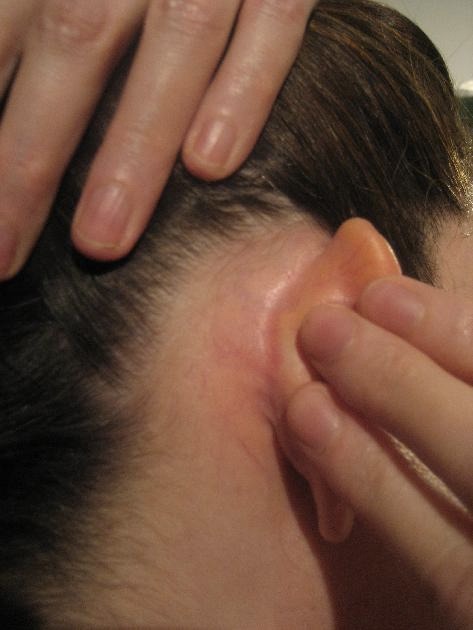 Upload Ear Photos Upload Ear Photos